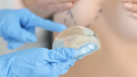 Mellnagyobbító műtét Dr. Fábián Zsolt rendelőjében